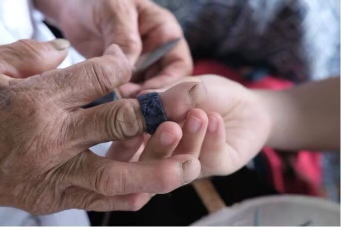 ̽��ָ��ˇ�g(sh��) �߽��l(xi��ng)���Ժ